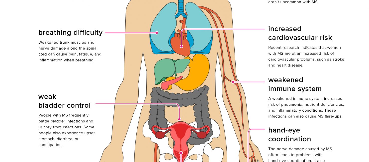 The Effects of Multiple Sclerosis on Your Body