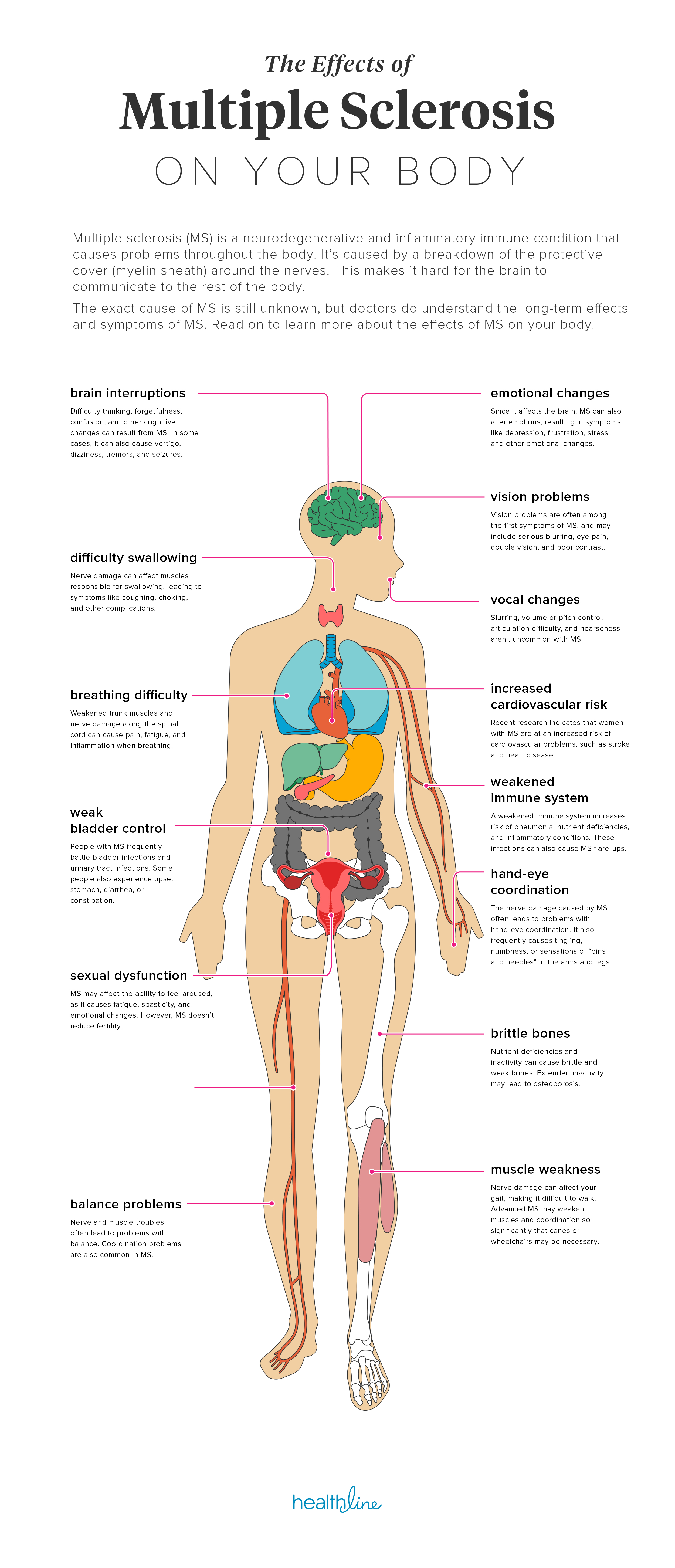 The Impact of Multiple Sclerosis on a