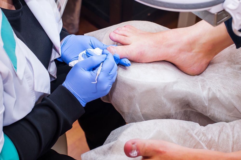 Foot Pain? What You Need To Know About Ingrown Toenails - HealthStatus