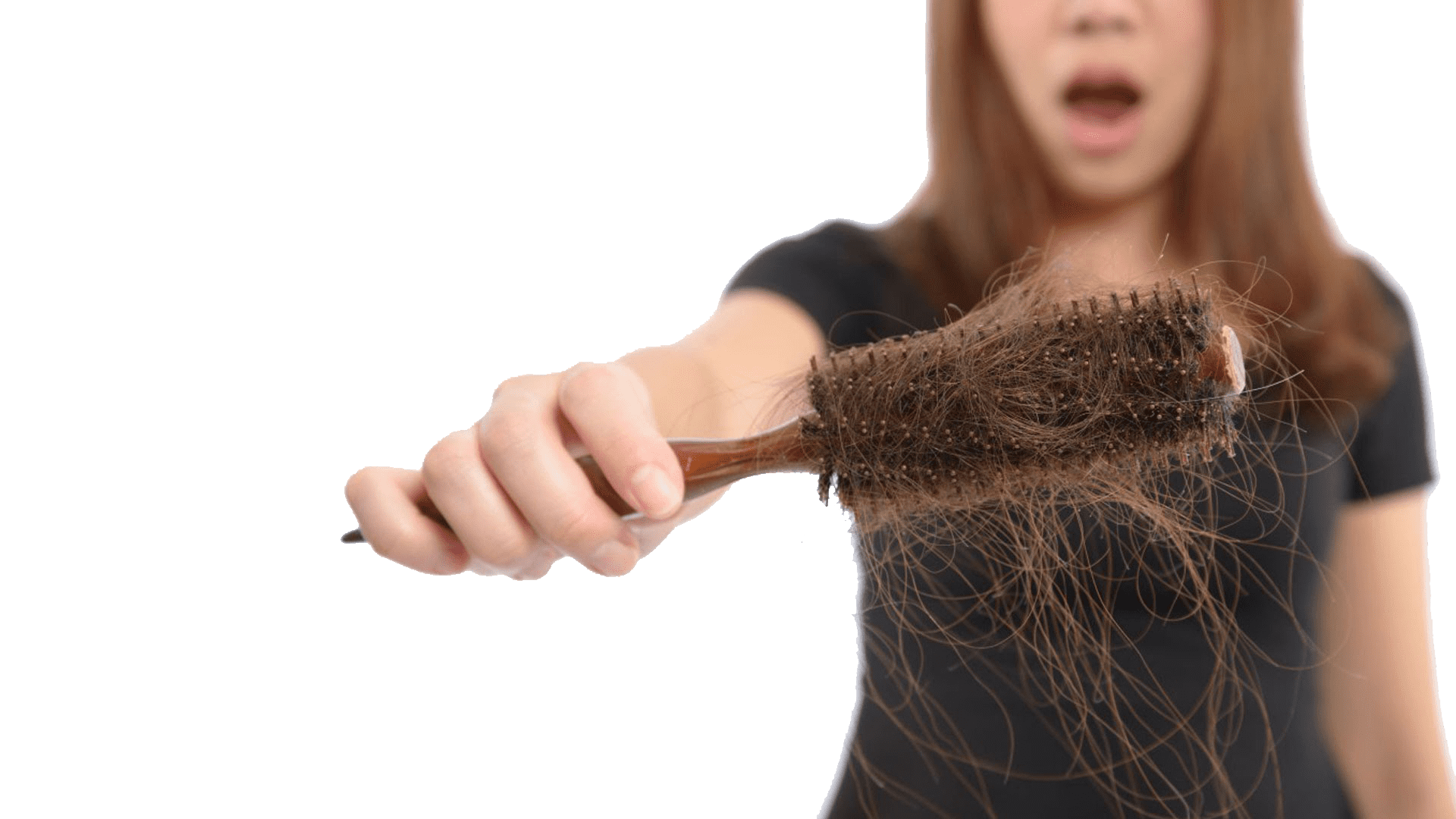 Best Hair Loss Treatment Healthstatus 2024 
